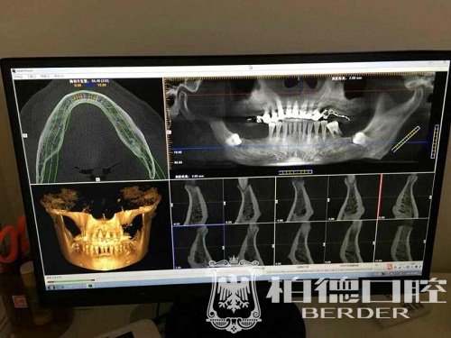 种牙怕痛，怎么办？