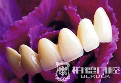 全瓷牙比烤瓷牙贵,为什么?