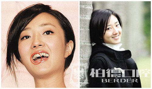 【征集令·挑战大咖】至强隐适美日来袭
