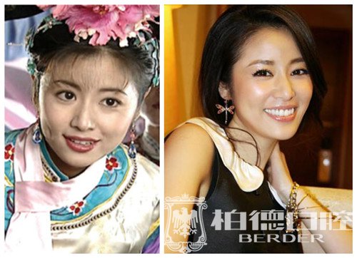【征集令·挑战大咖】至强隐适美日来袭