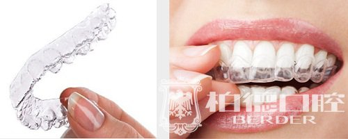 【征集令·挑战大咖】至强隐适美日来袭